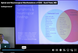 Spinal and Neurosurgical Manifestations of EDS